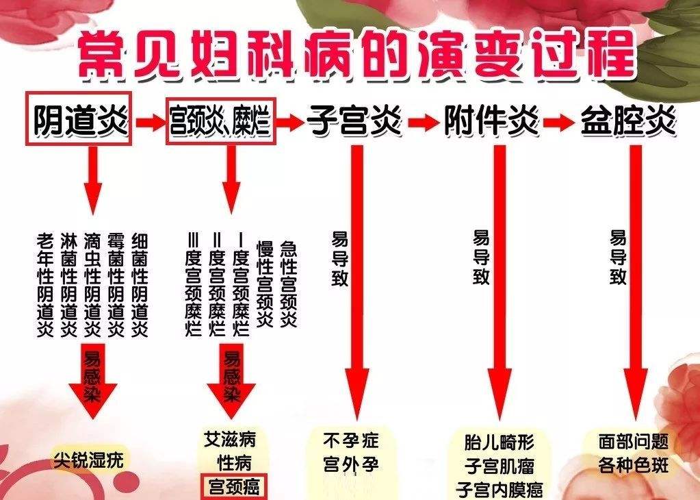 婦科凝膠OEM廠家：婦科疾病自檢大全 快快收藏